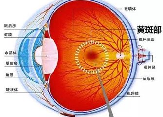 黃斑變性是怎么回事？黃斑變性的方法？