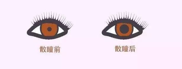 配眼鏡還散瞳，散瞳對眼睛有傷害嗎