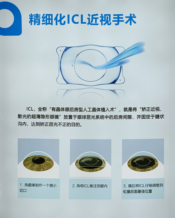 寒假摘鏡總動(dòng)員，近視朋友的三種矯正近視方式