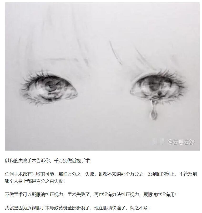教你，怎樣去了解近視手術(shù)  